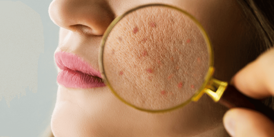 How Too Much Skincare Can Actually Damage Your Skin Barrier